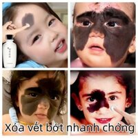 xóa vết bớt Kem Tẩy Hình Xăm Dầu loại bỏ vết bớt xoá xăm vĩnh viễn chăm sóc da  Làm mờ vết bớt màu đen