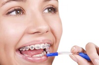 10 loại bàn chải đánh răng cho người niềng răng lông mềm mịn tốt nhất