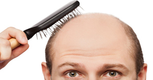 13 cách trị rụng tóc cho nam hiệu quả nhất hiện nay