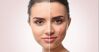 Bật mí cách lựa chọn kem dưỡng da trị mụn phù hợp