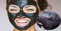 Các loại mặt nạ lột mụn đang được bán chạy hiện nay