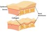 Các tác dụng phụ của Collagen