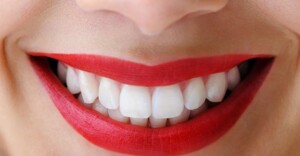 Có nên tẩy trắng răng không, tác hại và 4 lưu ý quan trọng cần biết
