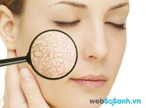 Da khô và 7 bí quyết bạn cần phải biết