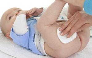 Hăm tã ở trẻ sơ sinh và những điều cần biết
