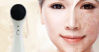 Kinh nghiệm chọn mua máy massage mặt ion 2 chế độ tốt nhất