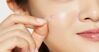 Miếng dán mụn có tác dụng gì? Cần lưu ý gì khi sử dụng?