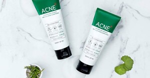 Review sữa rửa mặt Acne của Some By Mi AHA BHA PHA 30 Days