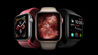 So sánh các loại Apple Watch Sport, Edition, Gen nên mua series nào?
