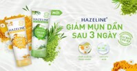 Sữa rửa mặt Hazeline có mấy loại? Công dụng ra sao?