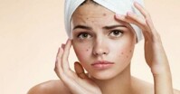 Tiêu chí lựa chọn sữa rửa mặt trị mụn cần biết