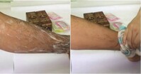 Tìm hiểu về sản phẩm kem tẩy lông Eskin