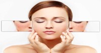 Top 3 sản phẩm sữa rửa mặt ngừa mụn tốt nhất hiện nay