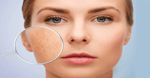 Top 4 nước hoa hồng se khít lỗ chân lông được lòng nhiều chị em