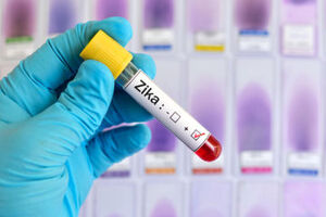 Virut Zika: Tất tần tật những điều mà các bà bầu phải biết