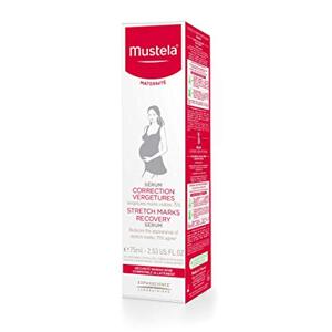 Kem dưỡng da Mustela Stretch Marks Recovery - 75ml