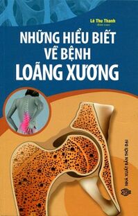 Những hiểu biết về bệnh loãng xương