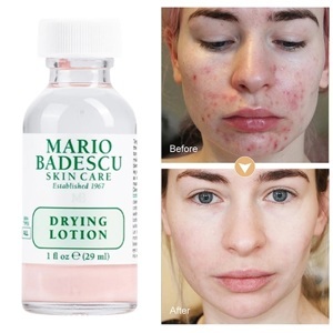 Chấm mụn Mario Badescu Drying Lotion 29ml