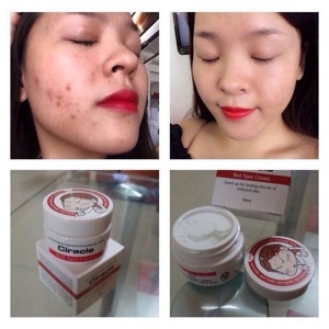 Kem đặc trị thâm mụn Ciracle Red spot Cream 30ml