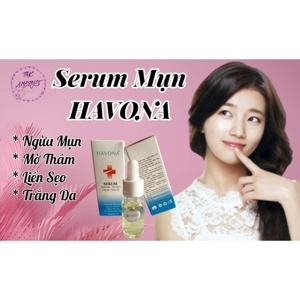 Kem ngừa mụn trị thâm trắng da Havona