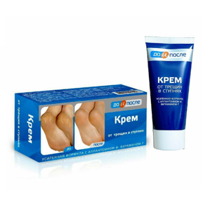 Kem trị nứt gót chân Kpem Apteka Nga 50ml