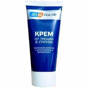 Kem trị nứt gót chân Kpem Apteka Nga 50ml