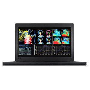 Máy tính bảng Lenovo IdeaTab A3000 - 16GB, Wifi + 3G, 7 inch