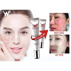 Serum đặc trị mụn tận gốc và làm đầy sẹo Acne Care Serum