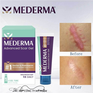 Thuốc Trị Sẹo Mederma advanced scare gel 50g